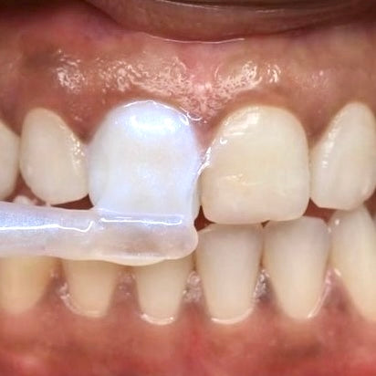 apply_tooth_gloss_2